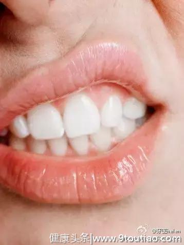 牙医Helen齿科中心——牙龈小科普