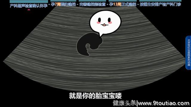 【科普动画】怀孕了，该做什么准备？