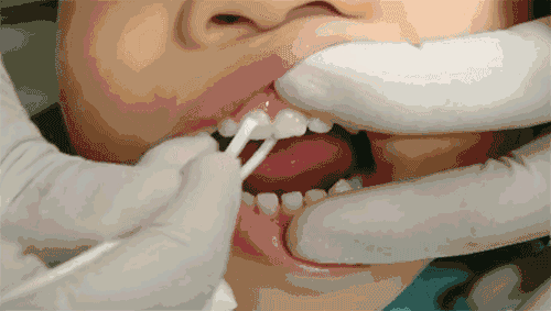 我梳理了一份儿童牙齿护理的清单，发现这些误区99%的孩子都中招