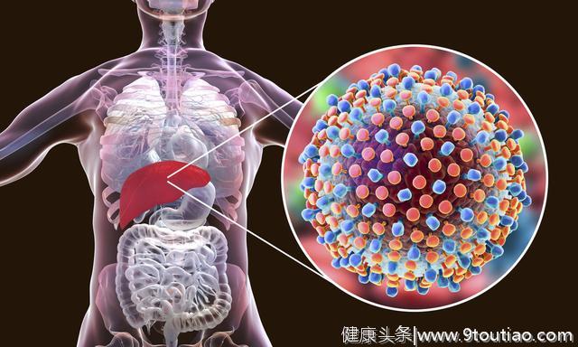 如何判断甲肝病情？认清身体这4种病理症状，避免耽误治疗