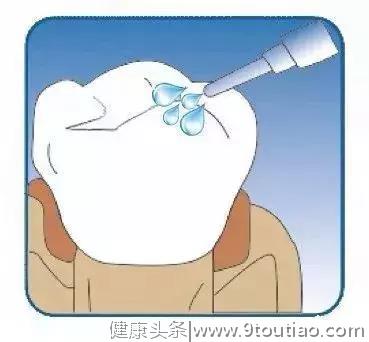 该如何保护孩子的牙齿呢？看这篇，教你正确的预防蛀牙的方法！