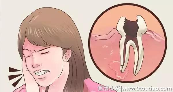 因为一颗烂牙，女子竟患上口腔癌！医生：这些口腔毛病要小心
