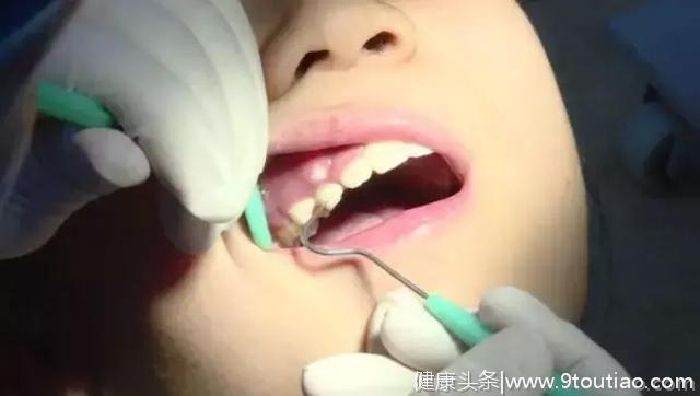 孩子牙齿怎么护理，看这篇就对了！