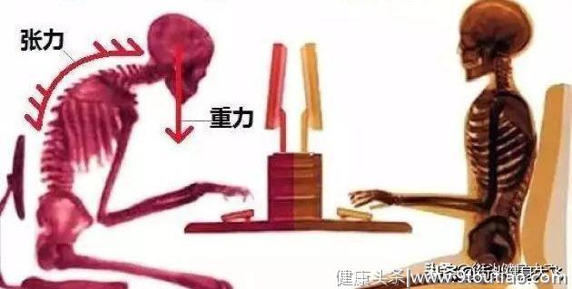 腰疼怎么办？6个妙招教你轻松缓解