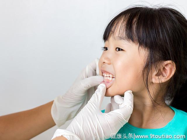 儿童牙齿把握黄金矫正期，牙医提供6大征兆，提醒家长注意