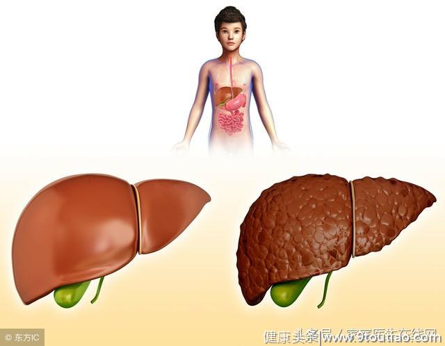 肝区隐痛可能是患上了肝病？这6种肝病，都会导致肝区疼痛