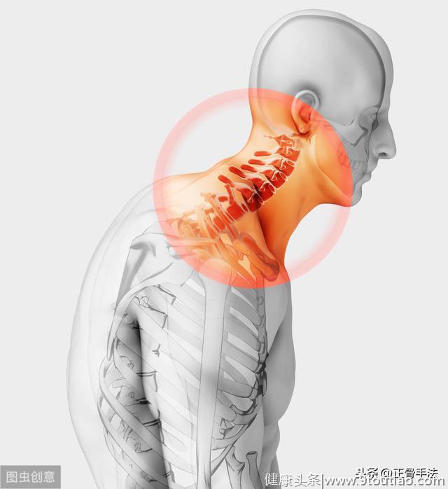9个步骤，教您如何实现颈椎病的自我康复调理，精细到具体时间点