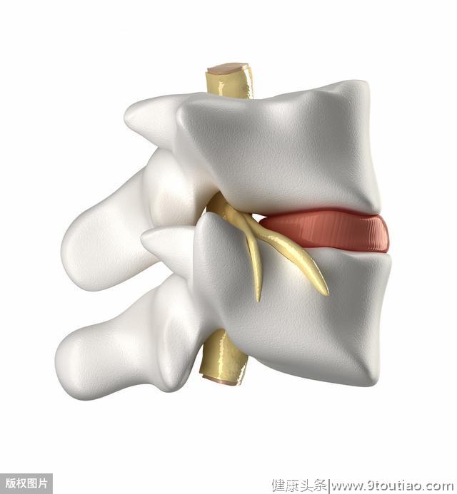 为何你的腰间盘如此突出，你跟别人哪里不一样？