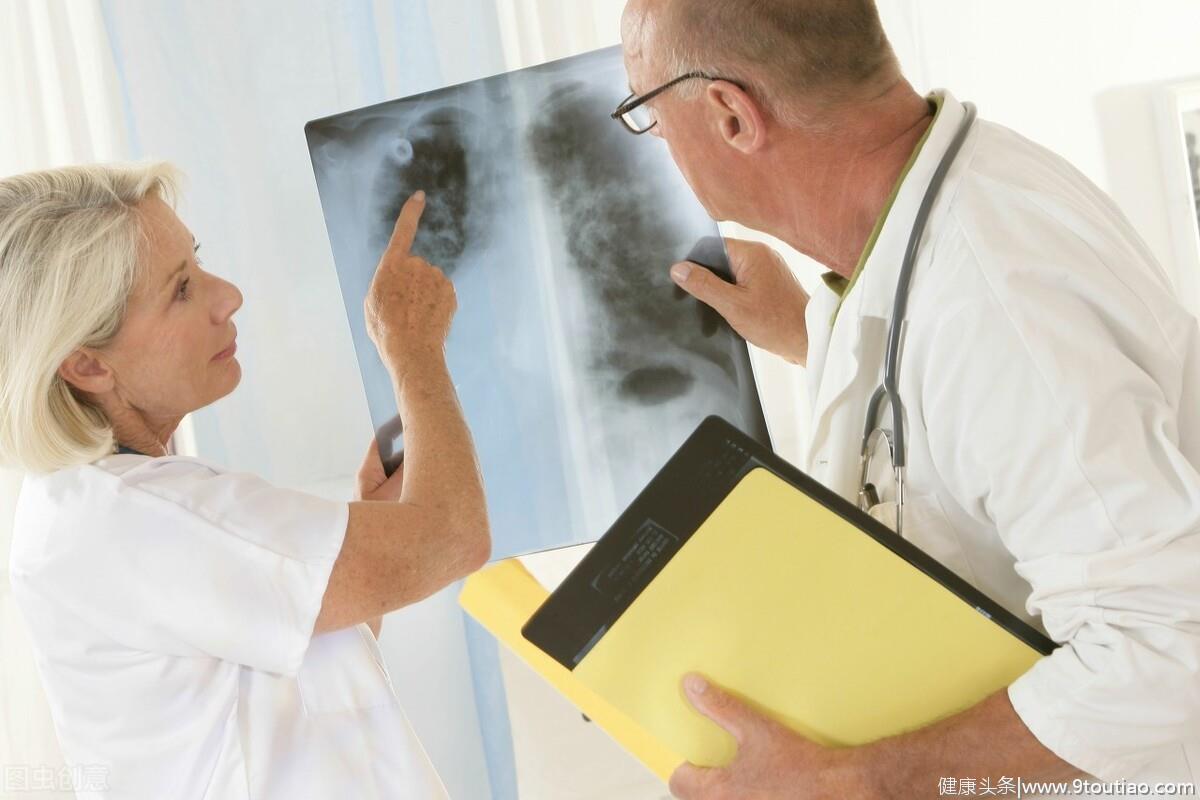 每年全球百万人死于肺癌，早期7个症状表现，及时发现能保命