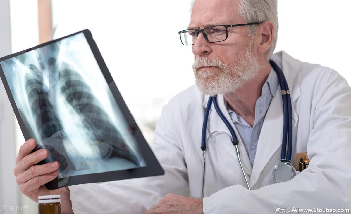 每年全球百万人死于肺癌，早期7个症状表现，及时发现能保命