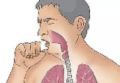 急性哮喘快速解